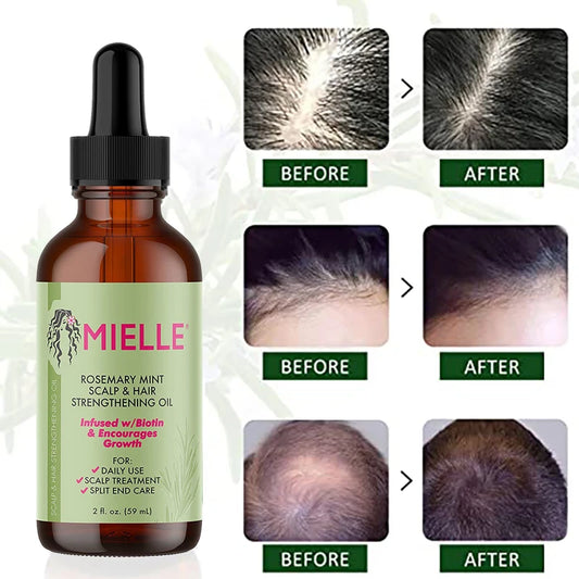 Ätherisches Mielle-Haarwachstumsöl, Rosmarin-Minze, Haarstärkungsöl, nährende Behandlung für Spliss und trockenes Haar von Mielle Organics