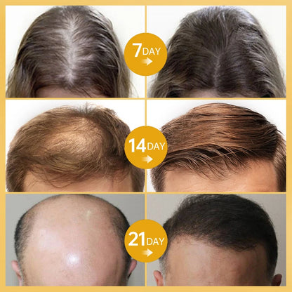 Mielle Hair Growth Essential Oil Rosemary Mint Hair Strengthening Oil