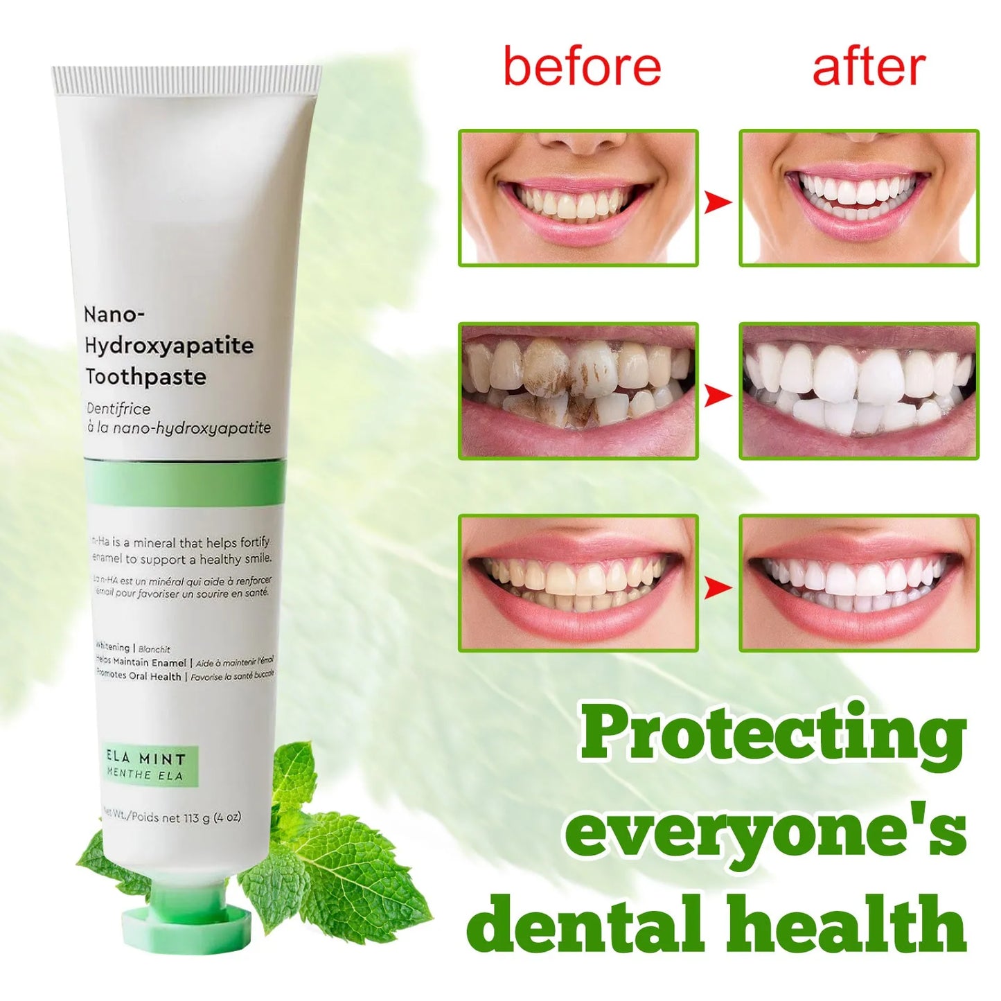 Fluoride Free Toothpaste Nano Hydroxyapatite